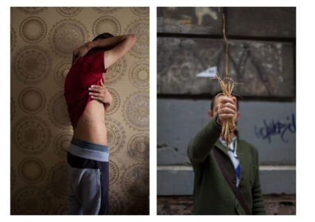 Bradley Secker Scars and memories